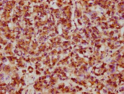 IHC image of RAC07424 diluted at 1:61.9 and staining in paraffin-embedded human pancreatic tissue performed on a Leica BondTM system. After dewaxing and hydration, antigen retrieval was mediated by high pressure in a citrate buffer (pH 6.0). Section was blocked with 10% normal goat serum 30min at RT. Then primary antibody (1% BSA) was incubated at 4? overnight. The primary is detected by a biotinylated secondary antibody and visualized using an HRP conjugated SP system.