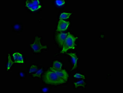 Immunofluorescence staining of MCF-7 cells with RAC07424 at 1:20, counter-stained with DAPI. The cells were fixed in 4% formaldehyde, permeabilized using 0.2% Triton X-100 and blocked in 10% normal Goat Serum. The cells were then incubated with the antibody overnight at 4?. The secondary antibody was Alexa Fluor 488-congugated AffiniPure Goat Anti-Rabbit IgG (H+L).