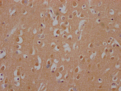 IHC image of RAC07425 diluted at 1:100 and staining in paraffin-embedded human brain tissue performed on a Leica BondTM system. After dewaxing and hydration, antigen retrieval was mediated by high pressure in a citrate buffer (pH 6.0). Section was blocked with 10% normal goat serum 30min at RT. Then primary antibody (1% BSA) was incubated at 4? overnight. The primary is detected by a Goat anti-rabbit IgG polymer labeled by HRP and visualized using 0.05% DAB.