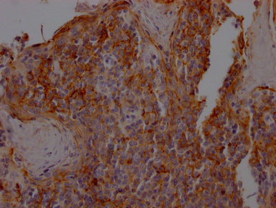 IHC image of RAC07426 diluted at 1:100 and staining in paraffin-embedded human tonsil tissue performed on a Leica BondTM system. After dewaxing and hydration, antigen retrieval was mediated by high pressure in a citrate buffer (pH 6.0). Section was blocked with 10% normal goat serum 30min at RT. Then primary antibody (1% BSA) was incubated at 4? overnight. The primary is detected by a Goat anti-rabbit IgG polymer labeled by HRP and visualized using 0.05% DAB.