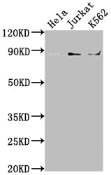 Western Blot; Positive WB detected in: Hela whole cell lysate, Jurkat whole cell lysate, K562 whole cell lysate; All lanes: IKBKB antibody at 1:2000; Secondary; Goat polyclonal to rabbit IgG at 1/50000 dilution; Predicted band size: 87, 86, 30, 80 kDa; Observed band size: 87 kDa