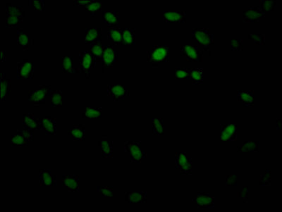Immunofluorescence staining of Hela Cells with RAC07431 at 1:50, counter-stained with DAPI. The cells were fixed in 4% formaldehyde, permeated by 0.2% TritonX-100, and blocked in 10% normal Goat Serum. The cells were then incubated with the antibody overnight at 4?. Nuclear DNA was labeled in blue with DAPI. The secondary antibody was FITC-conjugated AffiniPure Goat Anti-Rabbit IgG (H+L).