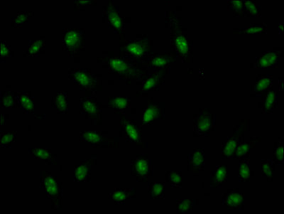 Immunofluorescence staining of Hela Cells with RAC07438 at 1:50, counter-stained with DAPI. The cells were fixed in 4% formaldehyde, permeated by 0.2% TritonX-100, and blocked in 10% normal Goat Serum. The cells were then incubated with the antibody overnight at 4?. Nuclear DNA was labeled in blue with DAPI. The secondary antibody was FITC-conjugated AffiniPure Goat Anti-Rabbit IgG (H+L).
