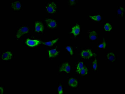Immunofluorescence staining of MCF7 Cells with RAC07439 at 1:50, counter-stained with DAPI. The cells were fixed in 4% formaldehyde and blocked in 10% normal Goat Serum. The cells were then incubated with the antibody overnight at 4?. Nuclear DNA was labeled in blue with DAPI. The secondary antibody was FITC-conjugated AffiniPure Goat Anti-Rabbit IgG (H+L).