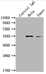 Immunoprecipitating ILK in Hela whole cell lysate; Lane 1: Rabbit control IgG instead of RAC07439 in Hela whole cell lysate.For western blotting,a HRP-conjugated Protein G antibody was used as the secondary antibody (1/2000); Lane 2: RAC07439(2ug)+ Hela whole cell lysate(500ug); Lane 3: Hela whole cell lysate (10ug)