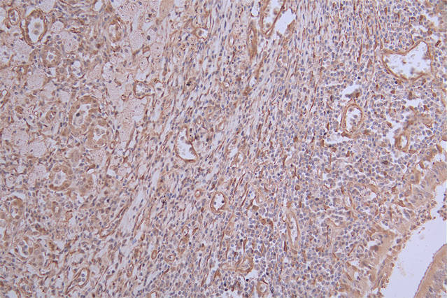 IHC image of RAC07442 diluted at 1:50 and staining in paraffin-embedded human lung tissue performed on a Leica BondTM system. After dewaxing and hydration, antigen retrieval was mediated by high pressure in a citrate buffer (pH 6.0). Section was blocked with 10% normal goat serum 30min at RT. Then primary antibody (1% BSA) was incubated at 4Â°C overnight. The primary is detected by a Goat anti-rabbit polymer IgG labeled by HRP and visualized using 0.24% DAB.