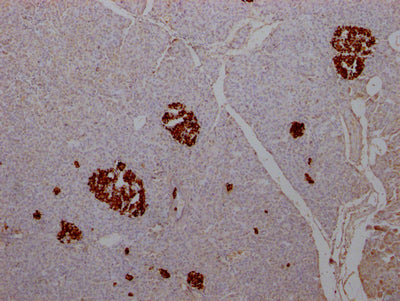 IHC image of RAC07443 diluted at 1:100 and staining in paraffin-embedded human pancreatic tissue performed on a Leica BondTM system. After dewaxing and hydration, antigen retrieval was mediated by high pressure in a citrate buffer (pH 6.0). Section was blocked with 10% normal goat serum 30min at RT. Then primary antibody (1% BSA) was incubated at 4? overnight. The primary is detected by a Goat anti-rabbit IgG polymer labeled by HRP and visualized using 0.05% DAB.