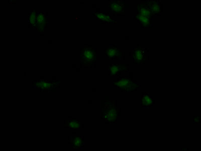 Immunofluorescence staining of MCF7 Cells with RAC07444 at 1:50, counter-stained with DAPI. The cells were fixed in 4% formaldehyde, permeated by 0.2% TritonX-100, and blocked in 10% normal Goat Serum. The cells were then incubated with the antibody overnight at 4?. Nuclear DNA was labeled in blue with DAPI. The secondary antibody was FITC-conjugated AffiniPure Goat Anti-Rabbit IgG (H+L).