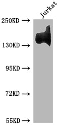 Western Blot; Positive WB detected in: Jurkat whole cell lysate; All lanes: ITGA4 antibody at 1:1500; Secondary; Goat polyclonal to rabbit IgG at 1/50000 dilution; Predicted band size: 115, 26 kDa; Observed band size: 140 kDa