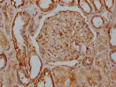 IHC image of RAC07446 diluted at 1:100 and staining in paraffin-embedded human kidney tissue performed on a Leica BondTM system. After dewaxing and hydration, antigen retrieval was mediated by high pressure in a citrate buffer (pH 6.0). Section was blocked with 10% normal goat serum 30min at RT. Then primary antibody (1% BSA) was incubated at 4? overnight. The primary is detected by a Goat anti-rabbit IgG polymer labeled by HRP and visualized using 0.05% DAB.