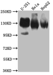 Western Blot; Positive WB detected in: U-251 whole cell lysate, Hela whole cell lysate, HepG2 whole cell lysate; All lanes: ITGAV antibody at 1:1000; Secondary; Goat polyclonal to rabbit IgG at 1/50000 dilution; Predicted band size: 117, 113, 112 kDa; Observed band size: 130 kDa