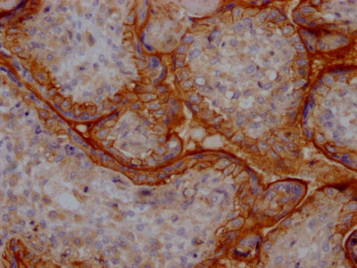 IHC image of RAC07447 diluted at 1:100 and staining in paraffin-embedded human placenta tissue performed on a Leica BondTM system. After dewaxing and hydration, antigen retrieval was mediated by high pressure in a citrate buffer (pH 6.0). Section was blocked with 10% normal goat serum 30min at RT. Then primary antibody (1% BSA) was incubated at 4? overnight. The primary is detected by a Goat anti-rabbit IgG polymer labeled by HRP and visualized using 0.05% DAB.