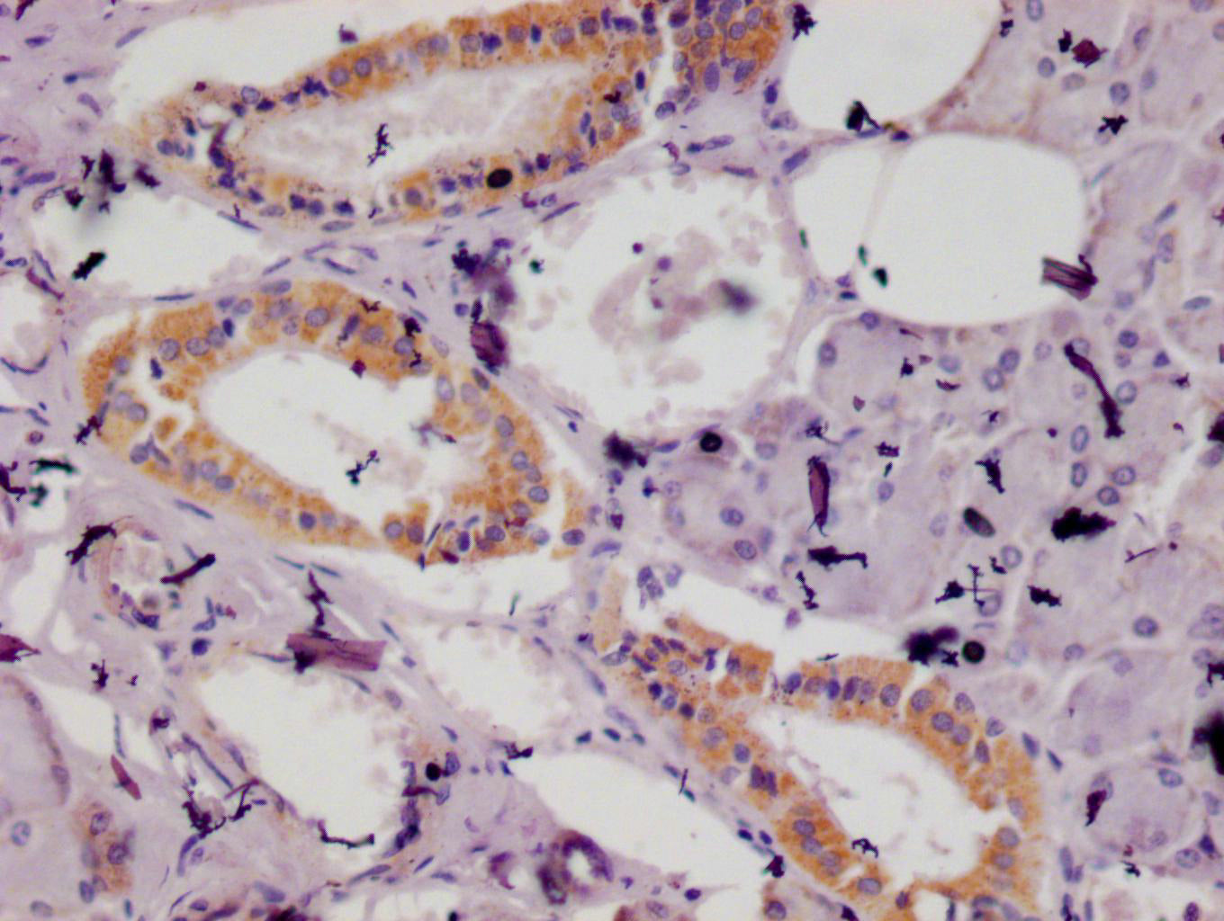 IHC image of RAC07450 diluted at 1:100 and staining in paraffin-embedded human salivary gland tissue performed on a Leica BondTM system. After dewaxing and hydration, antigen retrieval was mediated by high pressure in a citrate buffer (pH 6.0). Section was blocked with 10% normal goat serum 30min at RT. Then primary antibody (1% BSA) was incubated at 4Â°C overnight. The primary is detected by a Goat anti-rabbit polymer IgG labeled by HRP and visualized using 0.05% DAB.