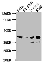 Western Blot; Positive WB detected in: Hela whole cell lysate, SH-SY5Y whole cell lysate, Jurkat whole cell lysate, K562 whole cell lysate; All lanes: ISL1 antibody at 1:2000; Secondary; Goat polyclonal to rabbit IgG at 1/50000 dilution; Predicted band size: 40 kDa; Observed band size: 39 kDa