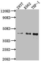 Western Blot; Positive WB detected in: 293T whole cell lysate, K562 whole cell lysate, THP-1 whole cell lysate; All lanes: Islet1 antibody at 1:1000; Secondary; Goat polyclonal to rabbit IgG at 1/50000 dilution; Predicted band size: 40 kDa; Observed band size: 40 kDa