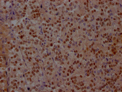 IHC image of RAC07452 diluted at 1:100 and staining in paraffin-embedded human adrenal gland tissue performed on a Leica BondTM system. After dewaxing and hydration, antigen retrieval was mediated by high pressure in a citrate buffer (pH 6.0). Section was blocked with 10% normal goat serum 30min at RT. Then primary antibody (1% BSA) was incubated at 4? overnight. The primary is detected by a Goat anti-rabbit IgG polymer labeled by HRP and visualized using 0.05% DAB.
