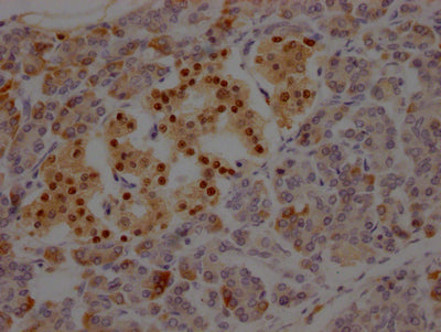IHC image of RAC07452 diluted at 1:100 and staining in paraffin-embedded human pancreatic tissue performed on a Leica BondTM system. After dewaxing and hydration, antigen retrieval was mediated by high pressure in a citrate buffer (pH 6.0). Section was blocked with 10% normal goat serum 30min at RT. Then primary antibody (1% BSA) was incubated at 4? overnight. The primary is detected by a Goat anti-rabbit IgG polymer labeled by HRP and visualized using 0.05% DAB.