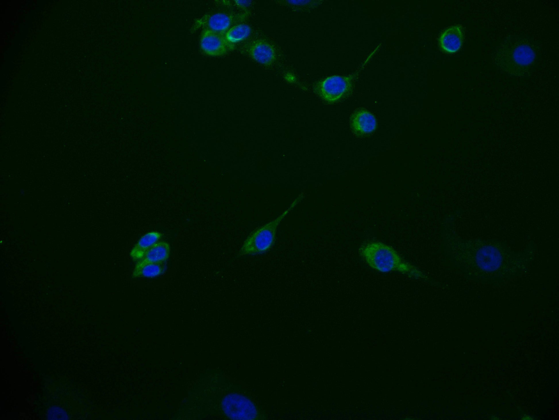 Immunofluorescence staining of MCF-7 cell with RAC07454 at 1:50, counter-stained with DAPI. The cells were fixed in 4% formaldehyde and blocked in 10% normal Goat Serum. The cells were then incubated with the antibody overnight at 4Â°C. The secondary antibody was Alexa Fluor 536-congugated AffiniPure Goat Anti-Rabbit IgG(H+L).