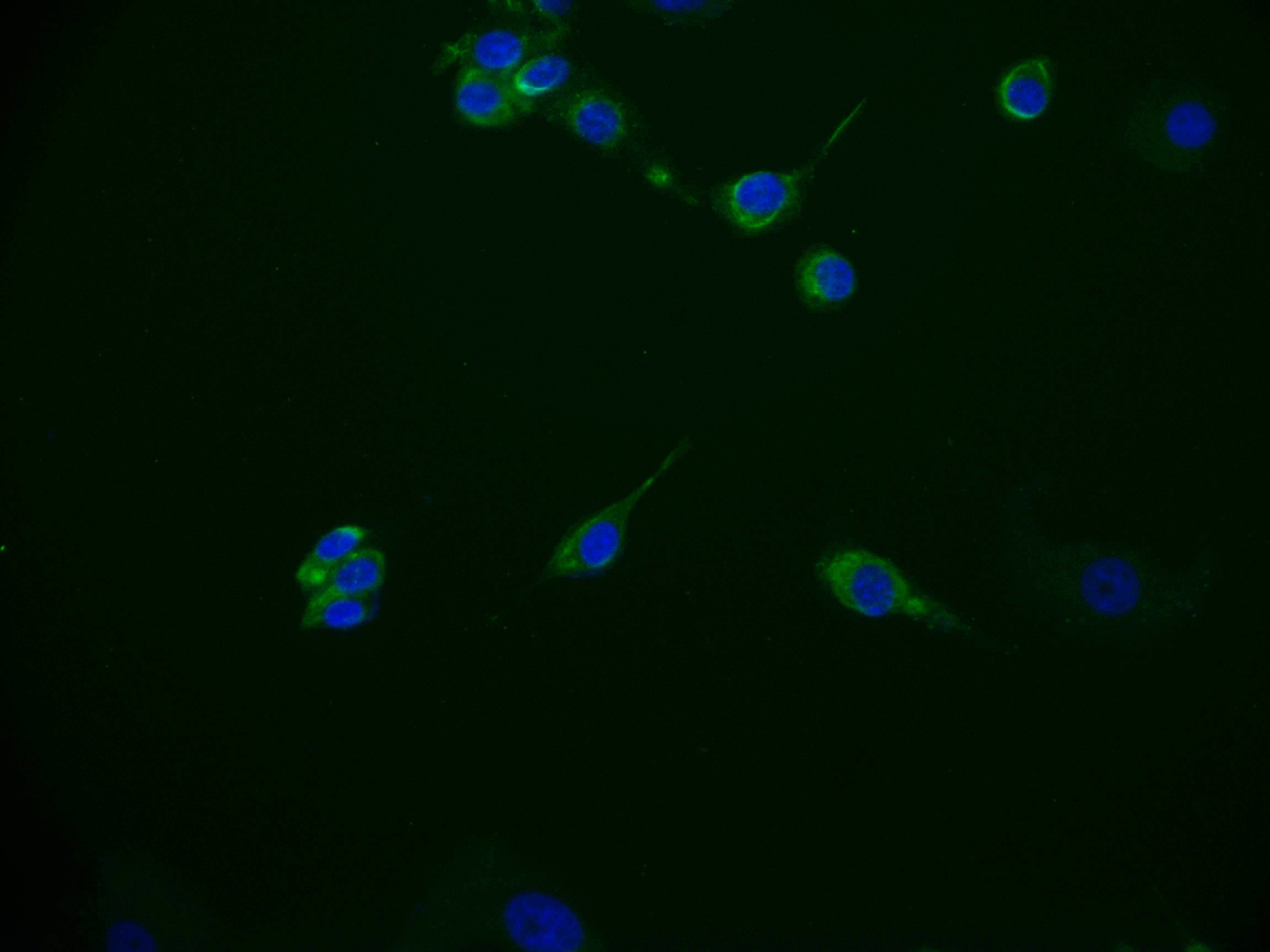 Immunofluorescence staining of MCF-7 cell with RAC07454 at 1:50, counter-stained with DAPI. The cells were fixed in 4% formaldehyde and blocked in 10% normal Goat Serum. The cells were then incubated with the antibody overnight at 4Â°C. The secondary antibody was Alexa Fluor 536-congugated AffiniPure Goat Anti-Rabbit IgG(H+L).