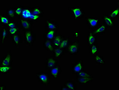 Immunofluorescence staining of Hela cells with RAC07456 at 1:61, counter-stained with DAPI. The cells were fixed in 4% formaldehyde, permeabilized using 0.2% Triton X-100 and blocked in 10% normal Goat Serum. The cells were then incubated with the antibody overnight at 4?. The secondary antibody was Alexa Fluor 488-congugated AffiniPure Goat Anti-Rabbit IgG (H+L).