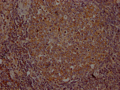 IHC image of RAC07457 diluted at 1:100 and staining in paraffin-embedded human lymph node tissue performed on a Leica BondTM system. After dewaxing and hydration, antigen retrieval was mediated by high pressure in a citrate buffer (pH 6.0). Section was blocked with 10% normal goat serum 30min at RT. Then primary antibody (1% BSA) was incubated at 4? overnight. The primary is detected by a Goat anti-rabbit IgG polymer labeled by HRP and visualized using 0.05% DAB.