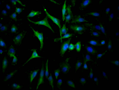 Immunofluorescence staining of Hela Cells with RAC07459 at 1:50, counter-stained with DAPI. The cells were fixed in 4% formaldehyde, permeated by 0.2% TritonX-100, and blocked in 10% normal Goat Serum. The cells were then incubated with the antibody overnight at 4?. Nuclear DNA was labeled in blue with DAPI. The secondary antibody was FITC-conjugated AffiniPure Goat Anti-Rabbit IgG (H+L).