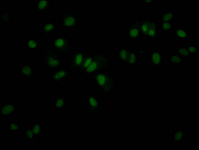 Immunofluorescence staining of MCF7 Cells with RAC07461 at 1:50, counter-stained with DAPI. The cells were fixed in 4% formaldehyde, permeated by 0.2% TritonX-100, and blocked in 10% normal Goat Serum. The cells were then incubated with the antibody overnight at 4?. Nuclear DNA was labeled in blue with DAPI. The secondary antibody was FITC-conjugated AffiniPure Goat Anti-Rabbit IgG (H+L).