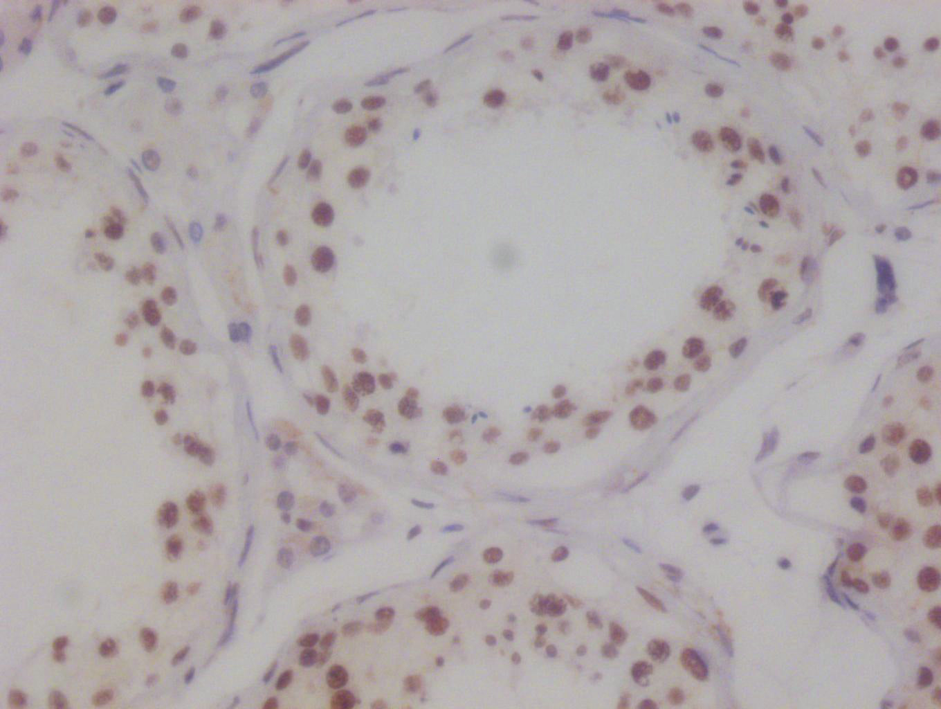 IHC image of RAC07462 diluted at 1:100 and staining in paraffin-embedded human testis tissue performed on a Leica BondTM system. After dewaxing and hydration, antigen retrieval was mediated by high pressure in a citrate buffer (pH 6.0). Section was blocked with 10% normal goat serum 30min at RT. Then primary antibody (1% BSA) was incubated at 4Â°C overnight. The primary is detected by a Goat anti-rabbit polymer IgG labeled by HRP and visualized using 0.05% DAB.
