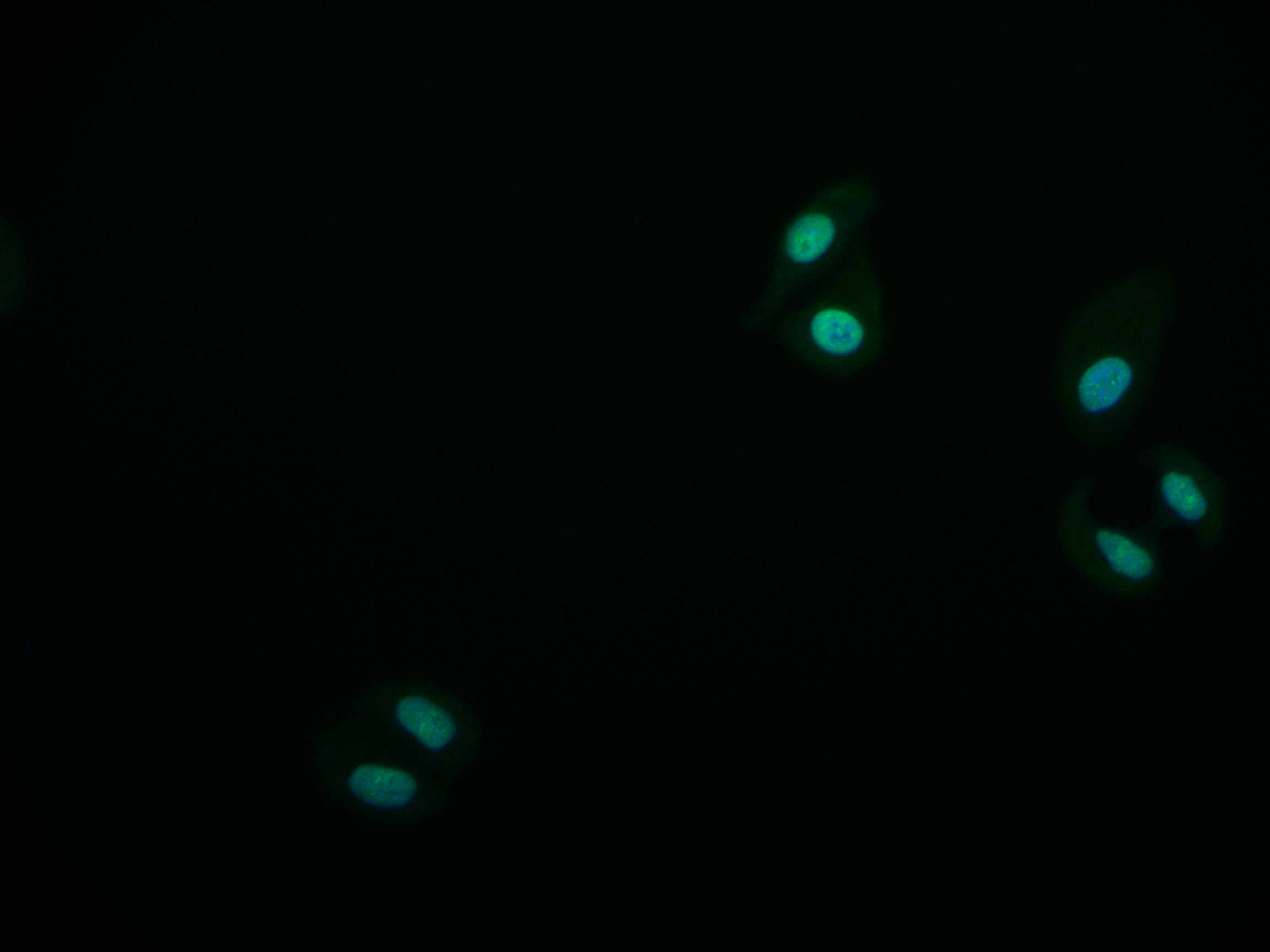 Immunofluorescence staining of HepG2 cell with RAC07462 at 1:50, counter-stained with DAPI. The cells were fixed in 4% formaldehyde and blocked in 10% normal Goat Serum. The cells were then incubated with the antibody overnight at 4Â°C. The secondary antibody was Alexa Fluor 587-congugated AffiniPure Goat Anti-Rabbit IgG(H+L).
