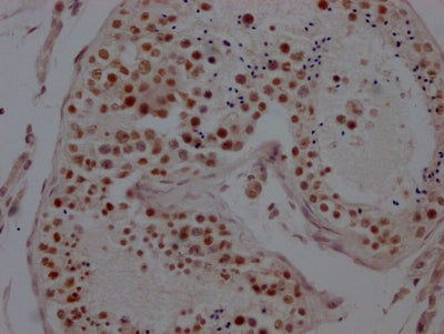 IHC image of RAC07463 diluted at 1:100 and staining in paraffin-embedded human testis tissue performed on a Leica BondTM system. After dewaxing and hydration, antigen retrieval was mediated by high pressure in a citrate buffer (pH 6.0). Section was blocked with 10% normal goat serum 30min at RT. Then primary antibody (1% BSA) was incubated at 4? overnight. The primary is detected by a Goat anti-rabbit IgG polymer labeled by HRP and visualized using 0.05% DAB.