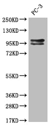 Western Blot; Positive WB detected in: Hela whole cell lysate; All lanes: KIFAP3 antibody at 1:2000; Secondary; Goat polyclonal to rabbit IgG at 1/50000 dilution; Predicted band size: 92, 87, 83 kDa; Observed band size: 72-95 kDa