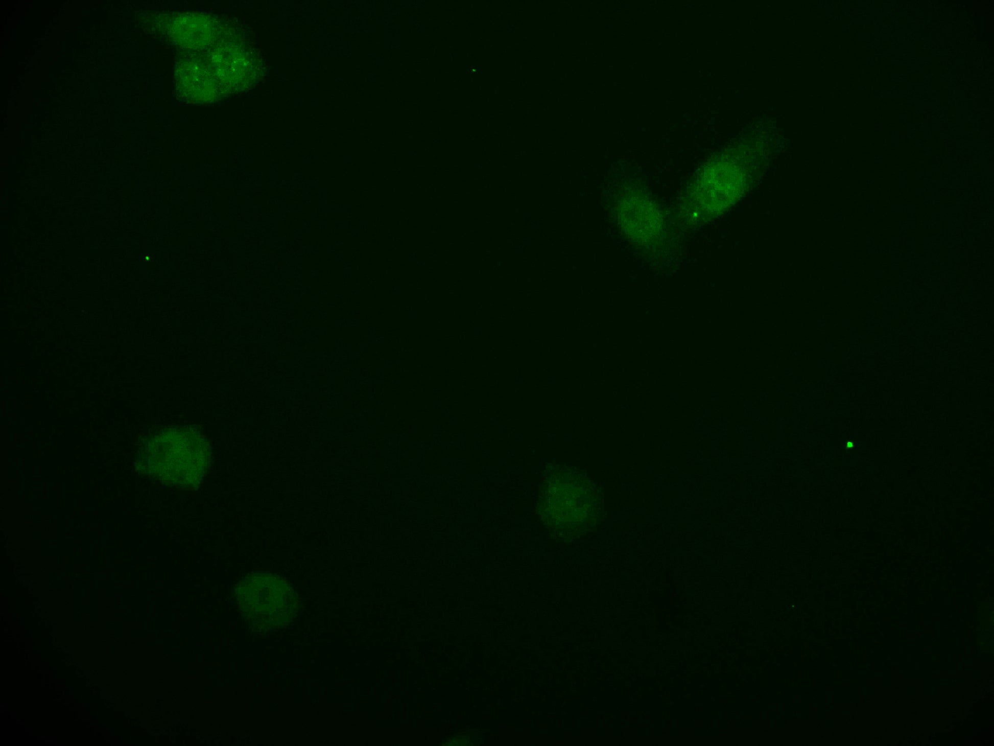 Immunofluorescence staining of PC-3 cell with RAC07465 at 1:50, counter-stained with DAPI. The cells were fixed in 4% formaldehyde and blocked in 10% normal Goat Serum. The cells were then incubated with the antibody overnight at 4Â°C. The secondary antibody was Alexa Fluor 552-congugated AffiniPure Goat Anti-Rabbit IgG(H+L).