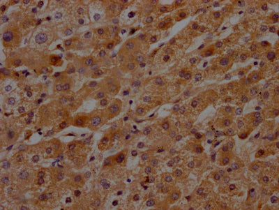 IHC image of RAC07466 diluted at 1:100 and staining in paraffin-embedded human liver tissue performed on a Leica BondTM system. After dewaxing and hydration, antigen retrieval was mediated by high pressure in a citrate buffer (pH 6.0). Section was blocked with 10% normal goat serum 30min at RT. Then primary antibody (1% BSA) was incubated at 4? overnight. The primary is detected by a Goat anti-rabbit IgG polymer labeled by HRP and visualized using 0.05% DAB.