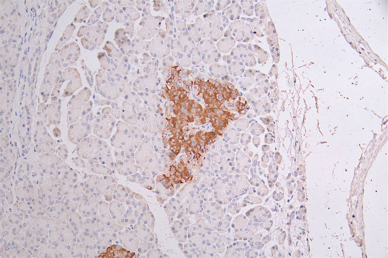 IHC image of RAC07471 diluted at 1:50 and staining in paraffin-embedded human pancreati tissue performed on a Leica BondTM system. After dewaxing and hydration, antigen retrieval was mediated by high pressure in a citrate buffer (pH 6.0). Section was blocked with 10% normal goat serum 30min at RT. Then primary antibody (1% BSA) was incubated at 4Â°C overnight. The primary is detected by a Goat anti-rabbit polymer IgG labeled by HRP and visualized using 0.34% DAB.