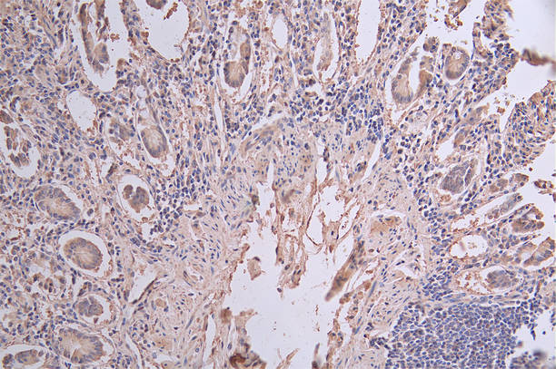 IHC image of RAC07472 diluted at 1:50 and staining in paraffin-embedded human small intestine tissue performed on a Leica BondTM system. After dewaxing and hydration, antigen retrieval was mediated by high pressure in a citrate buffer (pH 6.0). Section was blocked with 10% normal goat serum 30min at RT. Then primary antibody (1% BSA) was incubated at 4Â°C overnight. The primary is detected by a Goat anti-rabbit polymer IgG labeled by HRP and visualized using 0.61% DAB.