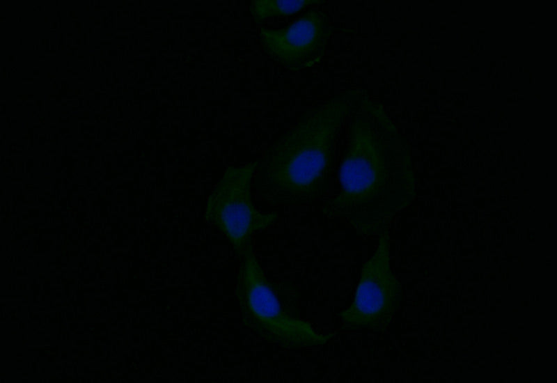 Immunofluorescence staining of A549 with RAC07473 at 1:10, counter-stained with DAPI. The cells were fixed in 4% formaldehyde and blocked in 10% normal Goat Serum. The cells were then incubated with the antibody overnight at 4Â°C. The secondary antibody was Alexa Fluor 519-congugated AffiniPure Goat Anti-Rabbit IgG(H+L).
