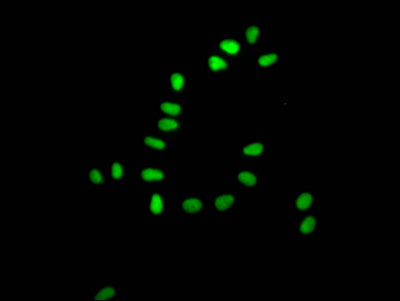 Immunofluorescence staining of Hela Cells with RAC07474 at 1:50, counter-stained with DAPI. The cells were fixed in 4% formaldehyde, permeated by 0.2% TritonX-100, and blocked in 10% normal Goat Serum. The cells were then incubated with the antibody overnight at 4?. Nuclear DNA was labeled in blue with DAPI. The secondary antibody was FITC-conjugated AffiniPure Goat Anti-Rabbit IgG (H+L).