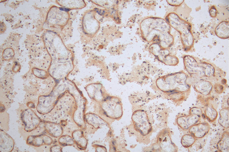 IHC image of RAC07478 diluted at 1:100 and staining in paraffin-embedded human placenta tissue performed on a Leica BondTM system. After dewaxing and hydration, antigen retrieval was mediated by high pressure in a citrate buffer (pH 6.0). Section was blocked with 10% normal goat serum 30min at RT. Then primary antibody (1% BSA) was incubated at 4Â°C overnight. The primary is detected by a Goat anti-rabbit polymer IgG labeled by HRP and visualized using 0.37% DAB.