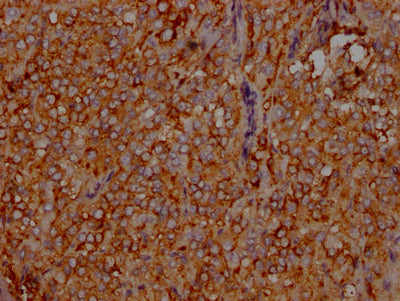 IHC image of RAC07481 diluted at 1:100 and staining in paraffin-embedded human adrenal gland tissue performed on a Leica BondTM system. After dewaxing and hydration, antigen retrieval was mediated by high pressure in a citrate buffer (pH 6.0). Section was blocked with 10% normal goat serum 30min at RT. Then primary antibody (1% BSA) was incubated at 4? overnight. The primary is detected by a Goat anti-rabbit IgG polymer labeled by HRP and visualized using 0.05% DAB.