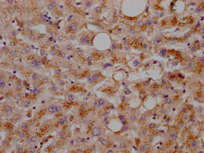 IHC image of RAC07481 diluted at 1:100 and staining in paraffin-embedded human liver tissue performed on a Leica BondTM system. After dewaxing and hydration, antigen retrieval was mediated by high pressure in a citrate buffer (pH 6.0). Section was blocked with 10% normal goat serum 30min at RT. Then primary antibody (1% BSA) was incubated at 4? overnight. The primary is detected by a Goat anti-rabbit IgG polymer labeled by HRP and visualized using 0.05% DAB.