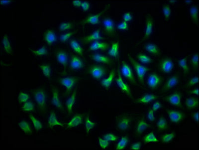 Immunofluorescence staining of Hela Cells with RAC07481 at 1:50, counter-stained with DAPI. The cells were fixed in 4% formaldehyde, permeated by 0.2% TritonX-100, and blocked in 10% normal Goat Serum. The cells were then incubated with the antibody overnight at 4?. Nuclear DNA was labeled in blue with DAPI. The secondary antibody was FITC-conjugated AffiniPure Goat Anti-Rabbit IgG (H+L).