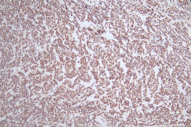 IHC image of RAC07482 diluted at 1:50 and staining in paraffin-embedded human tonsil tissue performed on a Leica BondTM system. After dewaxing and hydration, antigen retrieval was mediated by high pressure in a citrate buffer (pH 6.0). Section was blocked with 10% normal goat serum 30min at RT. Then primary antibody (1% BSA) was incubated at 4Â°C overnight. The primary is detected by a Goat anti-rabbit polymer IgG labeled by HRP and visualized using 0.52% DAB.