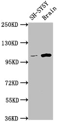 Western Blot; Positive WB detected in: SH-SY5Y whole cell lysate, Rat brain tissue; All lanes: LGR5 antibody at 1:1500; Secondary; Goat polyclonal to rabbit IgG at 1/50000 dilution; Predicted band size: 100, 98, 93 kDa; Observed band size: 100 kDa