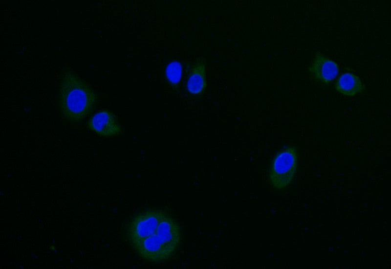 Immunofluorescence staining of hela with RAC07485 at 1:20, counter-stained with DAPI. The cells were fixed in 4% formaldehyde and blocked in 10% normal Goat Serum. The cells were then incubated with the antibody overnight at 4Â°C. The secondary antibody was Alexa Fluor 500-congugated AffiniPure Goat Anti-Rabbit IgG(H+L).