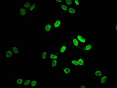 Immunofluorescence staining of Hela cells with RAC07486 at 1:38, counter-stained with DAPI. The cells were fixed in 4% formaldehyde, permeabilized using 0.2% Triton X-100 and blocked in 10% normal Goat Serum. The cells were then incubated with the antibody overnight at 4?. The secondary antibody was Alexa Fluor 488-congugated AffiniPure Goat Anti-Rabbit IgG (H+L).