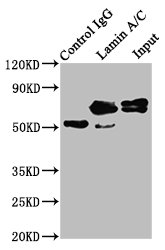 Immunoprecipitating Lamin A/C in Hela whole cell lysate; Lane 1: Rabbit control IgG instead of RAC07486 in Hela whole cell lysate.For western blotting, a HRP-conjugated Protein G antibody was used as the secondary antibody (1/2000); Lane 2: RAC07486 (3ug) + Hela whole cell lysate (500ug); Lane 3: Hela whole cell lysate (20ug)