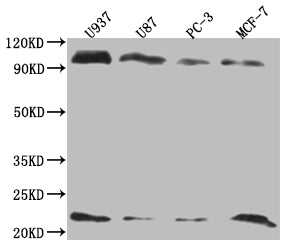 Western Blot; Positive WB detected in: U937 whole cell lysate, U87 whole cell lysate, PC3 whole cell lysate, MCF-7 whole cell lysate; All lanes: LMO2 antibody at 1:2000; Secondary; Goat polyclonal to rabbit IgG at 1/50000 dilution; Predicted band size: 19, 26, 6 kDa; Observed band size: 20-25, 90-100 kDa