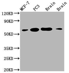 Western Blot; Positive WB detected in: MCF-7 whole cell lysate, PC3 whole cell lysate, Mouse brain tissue, Rat brain tissue; All lanes: LOXL2 antibody at 1:2000; Secondary; Goat polyclonal to rabbit IgG at 1/50000 dilution; Predicted band size: 87 kDa; Observed band size: 53 kDa