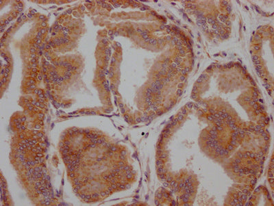 IHC image of RAC07488 diluted at 1:100 and staining in paraffin-embedded human prostate tissue performed on a Leica BondTM system. After dewaxing and hydration, antigen retrieval was mediated by high pressure in a citrate buffer (pH 6.0). Section was blocked with 10% normal goat serum 30min at RT. Then primary antibody (1% BSA) was incubated at 4? overnight. The primary is detected by a Goat anti-rabbit IgG polymer labeled by HRP and visualized using 0.05% DAB.