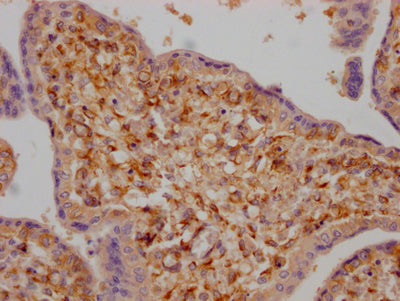 IHC image of RAC07488 diluted at 1:100 and staining in paraffin-embedded human placenta tissue performed on a Leica BondTM system. After dewaxing and hydration, antigen retrieval was mediated by high pressure in a citrate buffer (pH 6.0). Section was blocked with 10% normal goat serum 30min at RT. Then primary antibody (1% BSA) was incubated at 4? overnight. The primary is detected by a Goat anti-rabbit IgG polymer labeled by HRP and visualized using 0.05% DAB.
